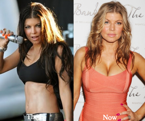 Fergie boob job before and after