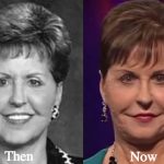 Joyce Meyer Plastic Surgery Before and After Photos