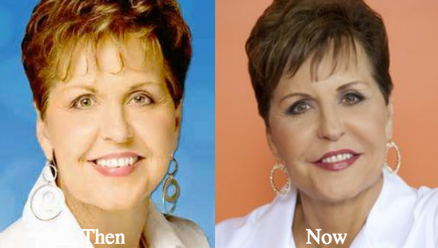 joyce-meyer-before-and-after