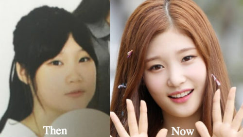 Jung Chae Yeon Plastic Surgery Before And After Photos Latest Plastic 1746