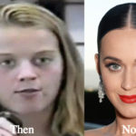 Katy Perry Plastic Surgery Before and After Photos