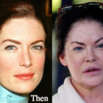 Lara Flynn Boyle Plastic Surgery Before and After Photos