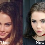 McKayla Maroney Plastic Surgery Before and After Photos