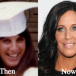 Patti Stanger Plastic Surgery Before and After Photos