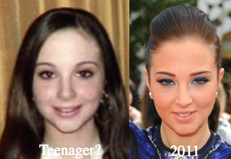 Tulisa young before plastic surgery