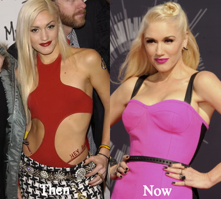 gwen stefani boob job before and after