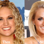 Carrie Underwood Plastic Surgery Before and After Photos