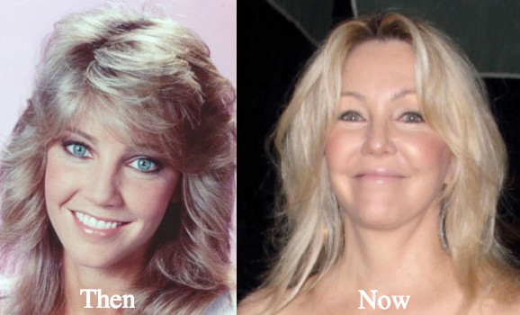 Heather Locklear Plastic Surgery Before and After Photos