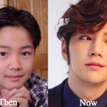 Jang Geun Suk Plastic Surgery Before and After Photos
