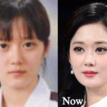 Jang Nara Plastic Surgery Before and After Photos