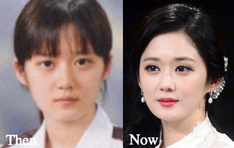 Jang Nara Plastic Surgery before and after photos