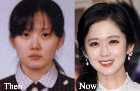 Jang Nara cosmetic surgery photos