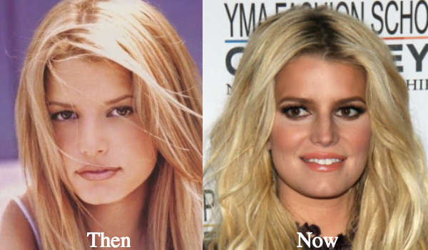 Jessica Simpson plastic surgery before and after photos