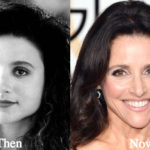 Julia Louis-Dreyfus Plastic Surgery Before and After Photos