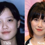 Ku Hye Sun Plastic Surgery Before and After Photos