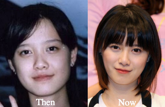 Ku Hye Sun Plastic Surgery Before and After Photos