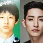 Lee Soo Hyuk Plastic Surgery Before and After Photos