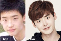 Lee Jong Suk Plastic Surgery Before and After Photos - Latest Plastic