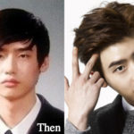 Lee Jong Suk Plastic Surgery Before and After Photos