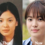 Song Hye Kyo Plastic Surgery Before and After Photos
