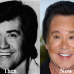 Wayne Newton Plastic Surgery Before and After Photos