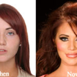 Amy Childs Plastic Surgery Before and After Photos