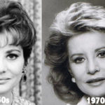 Barbara Walters Plastic Surgery Before and After Photos