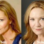 Joan Allen Plastic Surgery Before and After Photos