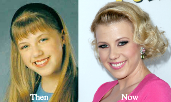 Jodie Sweetin botox injections facial fillers