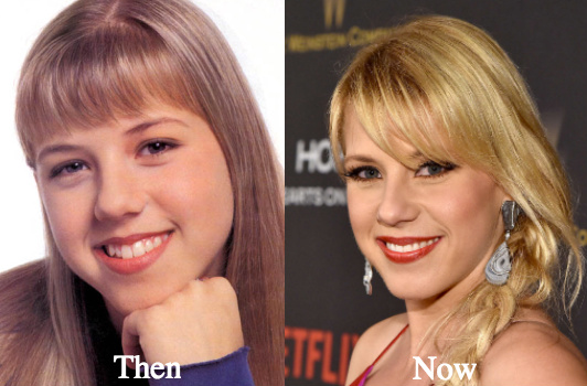 Jodie Sweetin plastic surgery before and after photos
