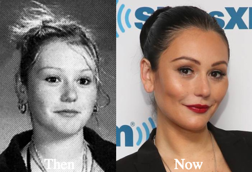 Jwoww plastic surgery before and after photos