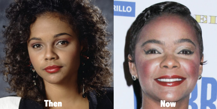 Lark Voorhies Plastic Surgery Before And After Photos Latest Plastic Surgery Gossip And News