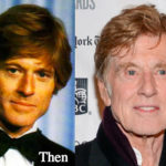 Robert Redford Plastic Surgery Before and After Photos