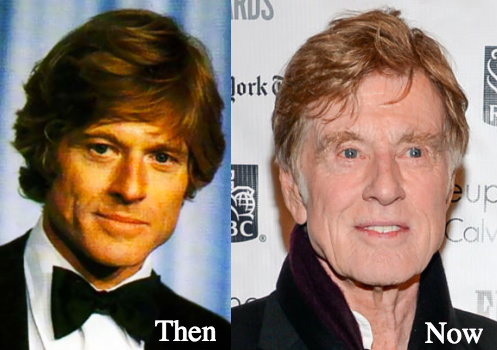 Robert Redford Plastic Surgery before and after photos
