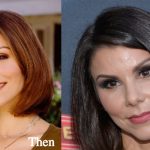Heather Dubrow Plastic Surgery Before and After Photos