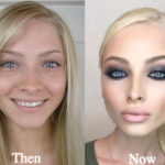 Alena Shishkova Plastic Surgery Before and After Photos