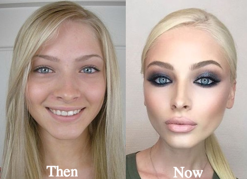 alena-shishkova-plastic-surgery-before-and-after-photos