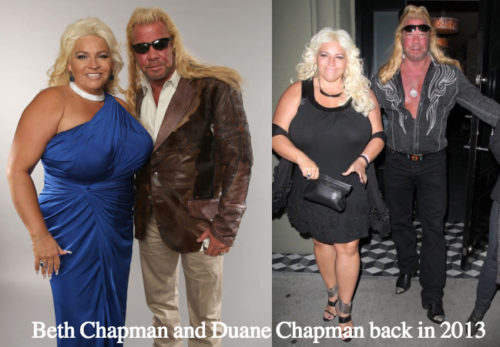 Beth Chapman Boobs Reduction Plastic Surgery Rumors - Latest Plastic