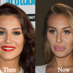 Chloe Goodman Plastic Surgery Before and After Photos