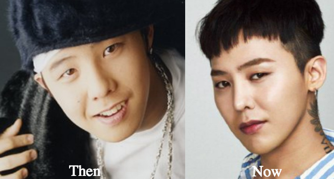 g-dragon-before-and-after