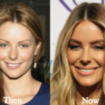 Jennifer Hawkins Plastic Surgery Before and After Photos