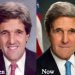 John Kerry Plastic Surgery Rumors Before and After Photos