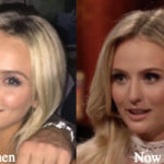 Lauren Bushnell Plastic Surgery Before and After Photos