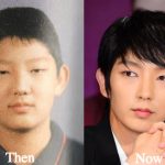 Lee Joon Gi Plastic Surgery Before and After Photos