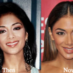 Nicole Scherzinger Plastic Surgery Before and After Photos
