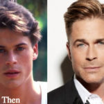 Rob Lowe Plastic Surgery Before and After Photos