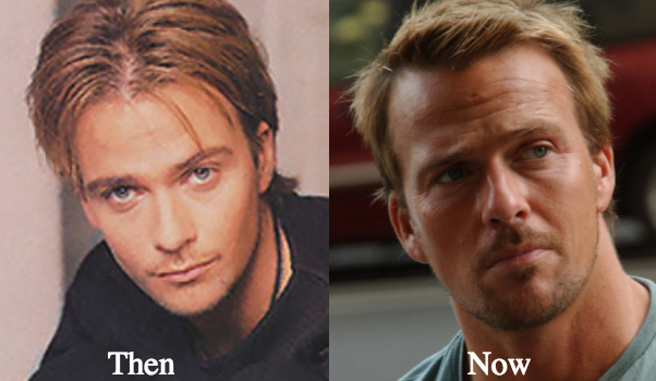 sean-patrick-flanery-plastic-surgery-before-and-after-photos