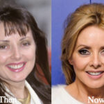 Carol Vorderman Plastic Surgery Before and After Photos