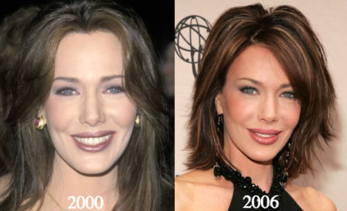 Hunter Tylo Plastic Surgery Before And After Photos Latest Plastic