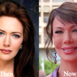 Hunter Tylo Plastic Surgery Before and After Photos